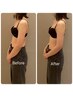 肩こり猫背ストレートネックの改善｜女性用｜姿勢矯正コース 60分¥6,500
