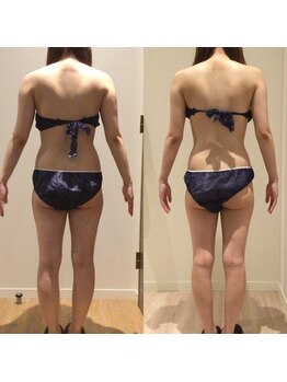 アユアランリンク 札幌店/20代/約2ヵ月/背面