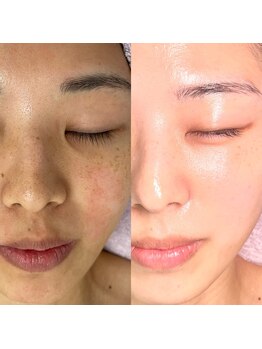 リトルーム(Litroom: from Seoul)/センシティブトリートメント