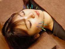 ハリトマト 梅田中崎の雰囲気（【浮腫ゼロへ】癖になる美容鍼のスッキリ感を是非）