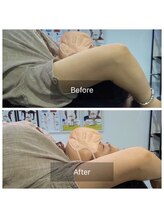 ナオル整体 三宮院(NAORU整体)/50代女性整体事例【肩の痛み】