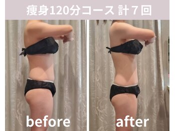 フェリシア(Felicia)/【痩身120分】計7回の結果