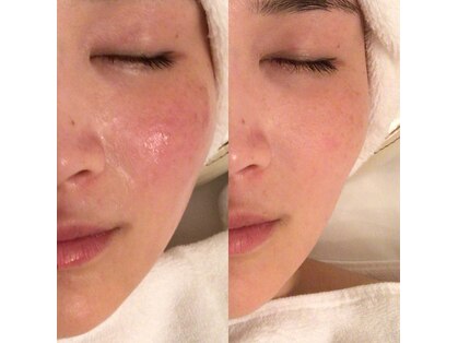 レオティアラ(REOTIARA)の写真