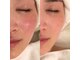 レオティアラ(REOTIARA)の写真