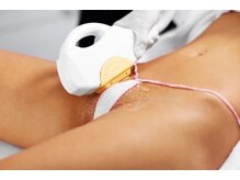 シエル(Ciel)/★都度払い有★VIO脱毛