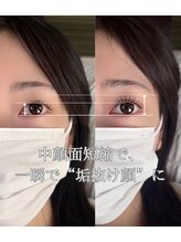エルア 大阪梅田本店(elua) 眉毛まつげ No.1セット