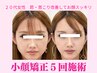 【人気No2速攻小顔×全身矯正】筋膜×猫背矯正×リンパ×小顔肋骨矯正 90分