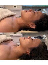 ブリア 横浜(BRILLA)/MDNA.SKIN 潤い爆弾クレイパック