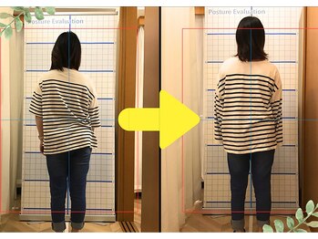 ぎふと整体院/Befor&After