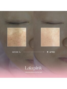 グラッソ(GRASSO)/ララピンク