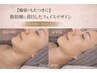 【輪郭・顔の脂肪たるみ・もたつきに】リアボーテ フェイスデザイン70分