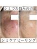 【頑固なシミ改善】30代以上からのシミ予防☆シミケアピーリング