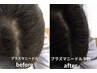 ◎オススメ◎頭皮プラズマ￥9800　プチヘッドマッサージ付き♪