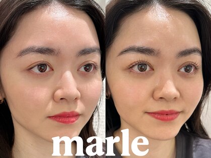 マルレ アイサロン 三軒茶屋(MARLE eyesalon)の写真