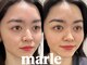 マルレ アイサロン 三軒茶屋(MARLE eyesalon)の写真