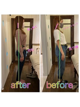 ヒカリノキュウジツ(Hikarino休日)/姿勢矯正ビフォアフ