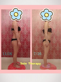 ソワンテラピー(Soin Therapy)/横からもほっそり