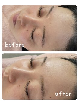 シャングリ ラ(Shangri La)/話題の【エニシーグローパック】