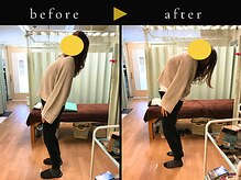 杉本接骨鍼灸院/背骨から全身がユルユル整体