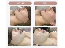 瞬時に作り出す小顔術が得意です。