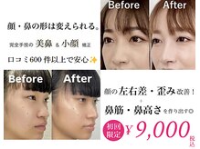 ラプリボーテ(Raplit BEAUTE)