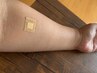 《大切なお肌の為に★》パッチテスト＋カウンセリング　無料