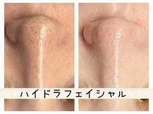 ナースセレクトサロン(Nurse select salon)/