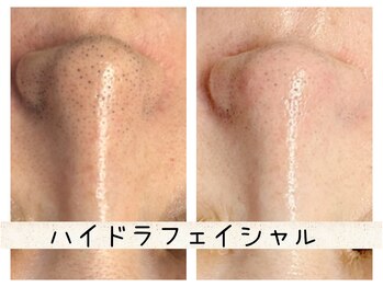 ナースセレクトサロン(Nurse select salon)/
