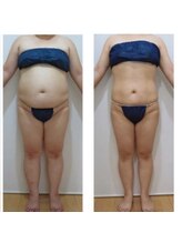 デイスパ ヴィータ/