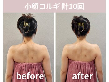 フェリシア(Felicia)/【小顔コルギ】計10回の結果