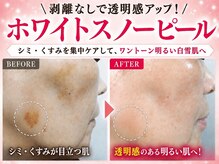スイ 昭島店(Sui)の雰囲気(夏に向けて輝く素肌へ!1回で首元までトーンUPする白雪肌エステ)