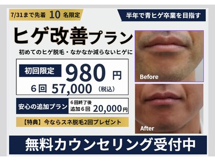 ベル 小倉(Belle)の写真