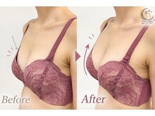 ヴェルナ(VELUNA)の雰囲気（デコルテ削げ・下垂や離れ乳のお悩み、お気軽にご相談ください★）