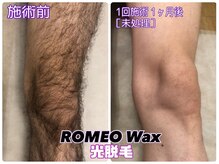 ロミオワックス ジュリエットワックス 新宿店(ROMEO Wax Juliet Wax)/春キャン★光脱毛【1】足オール!