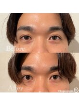 エクボ 立川店(EKUBO)/目元スッキリぱっちり印象up☆