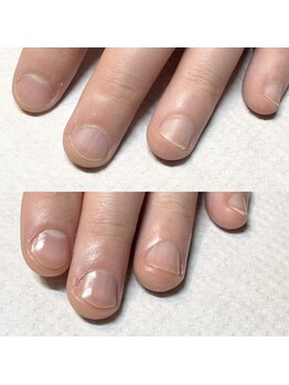 ポノ(pono)/ハンドケアコース