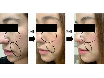 アイチューズ(ICHOOSE)/