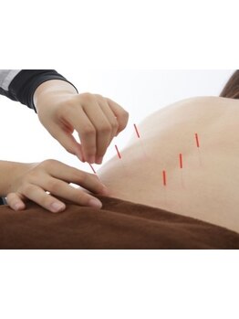 鍼灸施術を受けたい