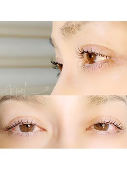 ノエル 上野店(Noel)/上下まつげパーマ