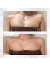 アカシア(acacia)/【産後バスト】ボリュームアップ