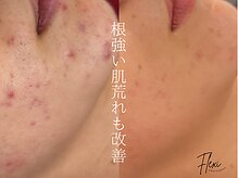 フレキシ 表参道(Flexi)