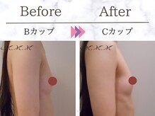 エムエムエム 表参道Luxeサロン(M.M.M)/【バストアップ例】　B→Cカップ