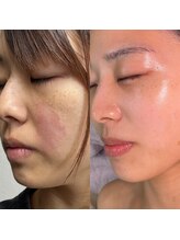 リトルーム(Litroom: from Seoul)/センシティブトリートメント