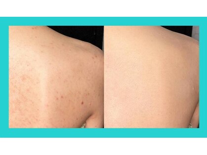 キッカ 梅田天六(Kikka)の写真