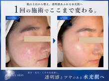 ジュエリースキン(JewelrySkin)の雰囲気(その肌悩みを→肌質別×オーダーメイドで叶える“理想美肌”へ)
