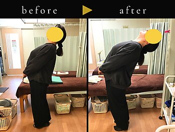 杉本接骨鍼灸院/背骨から全身がユルユル整体