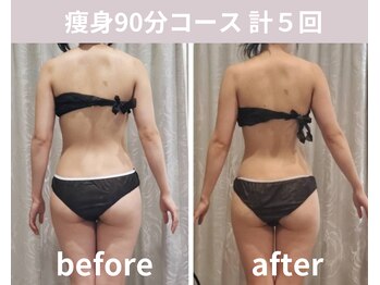 フェリシア(Felicia)/【痩身90分】計5回の結果