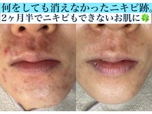 ネッコ(necco)の雰囲気（毛穴が変わればお肌も変わります！！）