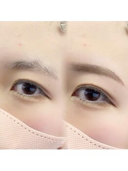 チルアンドアイ 千葉駅前店(Chill&Eye)/美眉スタイリング/BeforeAfter