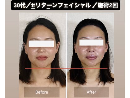 真美(Sinbi)の写真
